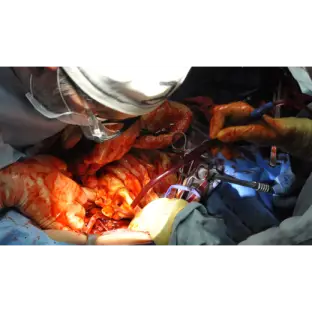 Advanced Surgical Skills Packages - Träning/Simulering